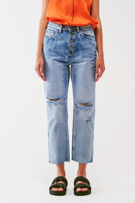 Sraight-Leg Jeans With Exposed Buttons And Ripped Knees
